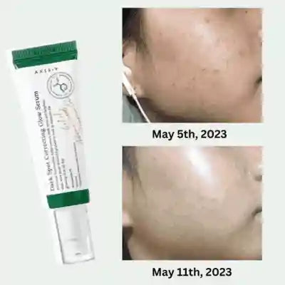 AXIS-Y Dark Spot Correcting Glow Serum