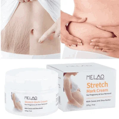 Melao Stretch Mark Cream