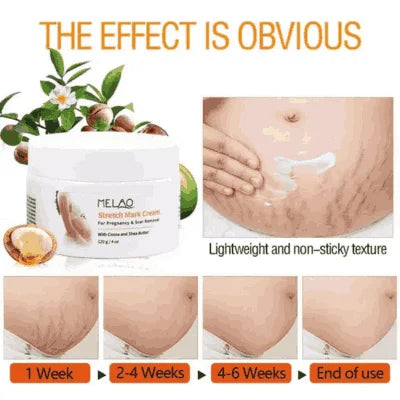 Melao Stretch Mark Cream