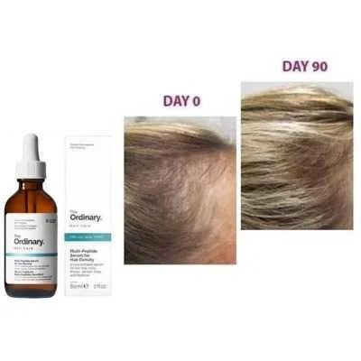 The Ordinary Multi-Peptide Serum for Hair Density